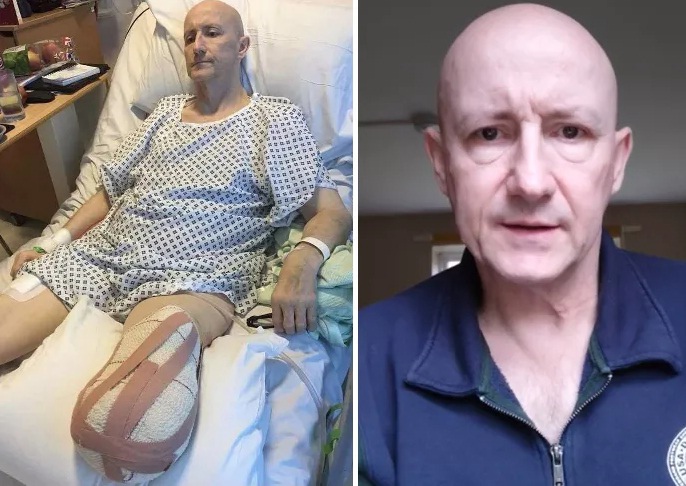 "Corona"-Impfschaden Thailand:
Nach der "Coronaimpfung"
Thrombose+Beinverlust "Corona"-Impfschaden Thailand: Nach
der "Coronaimpfung"
Thrombose+Beinverlust