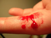 Blut am Finger: Menschen
                          mit Amalgamfllungen haben eine erhhte
                          Quecksilberbelastung im Blut.