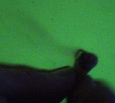 Quecksilberdampf entweicht 24 Stunden
                              pro Tag und Nacht aus Amalgamf�llungen,
                              und so rauchen die Z�hne Tag und Nacht und
                              stossen das Giftgas Quecksilber aus den
                              Amalgamf�llungen aus