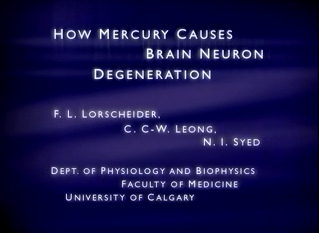 Film �ber
                              Quecksilberwirkung an Nerven 02: Titel
                              "How mercury causes brain neuron
                              degeneration", von F.L. Lorscheider,
                              C.C.-W. Leong und N.Y. Syed, von der
                              Abteilung Physiologie und Biophysiologie
                              der Medizinischen Fakult�t der Universit�t
                              Calgary