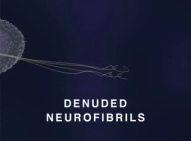 Film ber
                                              Quecksilberwirkung an
                                              Nerven: Es bleiben nur
                                              noch nackte Nervenfasern
                                              (engl.: "denuded
                                              neurofibrils") brig