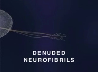 Film �ber
                                              Quecksilberwirkung an
                                              Nerven: Es bleiben nur
                                              noch nackte Nervenfasern
                                              (engl.: "denuded
                                              neurofibrils") �brig