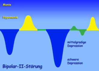 Schema
                    der Bipolar-II-St�rung