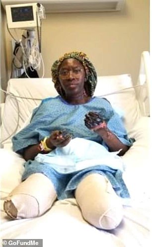 Minnesota
                    ("USA") 28.7.2021: Schwarzer Pilz nach
                    GENimpfung: Unterschenkel weg - bald auch Hände weg:
                    Nach der Covid-Impfung verliert eine Frau beide
                    Beine