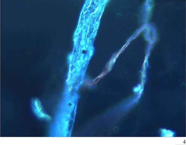 Mann mit
                      Pfizer hat Blutschaden: eine selbstaggregierende
                      Strukturierung