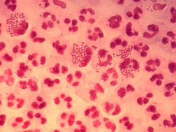 Microbes (ici:
                        Neisseria gonorrhoeae) peuvent imiter les
                        antignes et ainsi djouer le systme
                        immunitaire quand le rgime alimentaire ne
                        correspond pas au groupe sanguin.