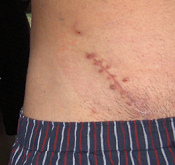 und f�r eine
                          optimale Wundheilung ist die
                          Blutgruppenern�hrung mitentscheidend