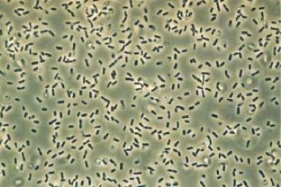 Bakterien wie Bacillus subtilis
                          ("Heubazillus") knnen durch
                          Farbbestrahlung abgettet werden
