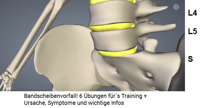 Lendenwirbel L4 und L5 sowie das Sacrum,
                      Schema
