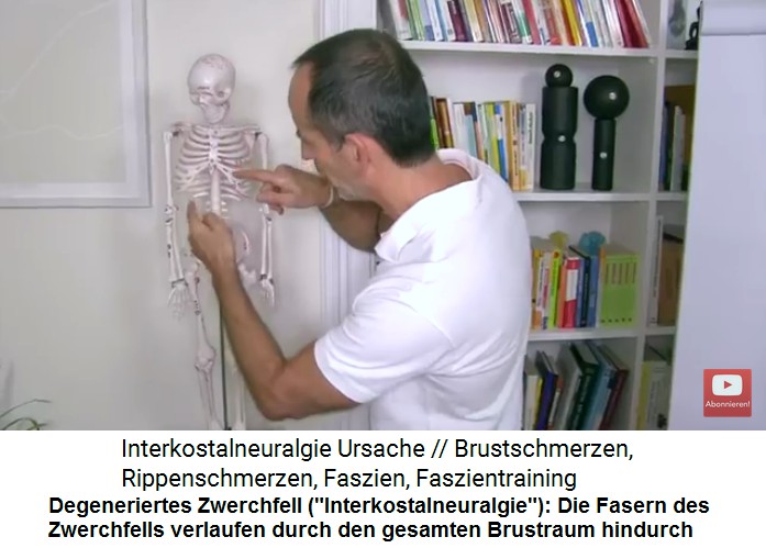 Intercostalneuralgie
                      Video 1: Die Zwerchfellfasern verlaufen durch den
                      gesamten Brustraum