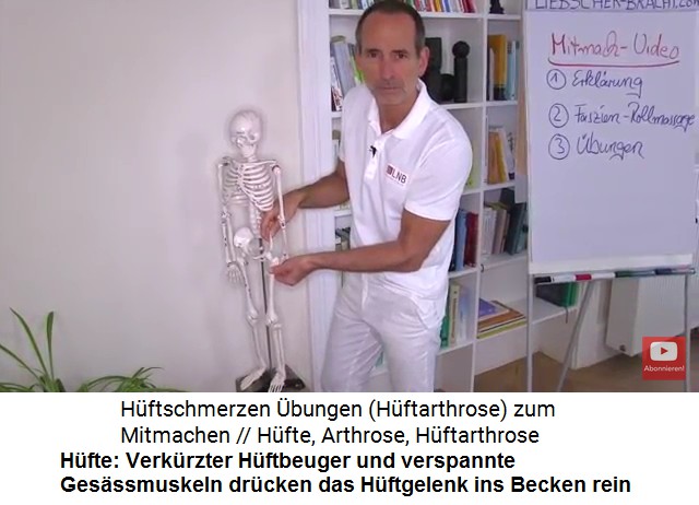 Liebscher-Bracht mit dem
                      Skelettmodell: Der verk�rzte H�ftbeuger und
                      verspannte Ges�ssmuskeln dr�cken das H�ftgelenk
                      ins Becken rein