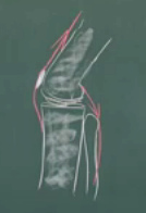 Das Kniegelenk mit Oberschenkelstrecker
                        (rot nach oben) und Wadenmuskel (rot nach unten)
                        mit Zugkr�ften