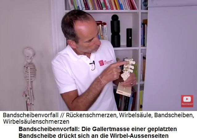 Die Gallertmasse
                              der geplatzten Bandscheibe dr�ckt sich an
                              die Wirbel-Aussenseiten