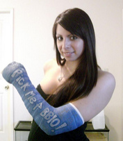 Gipsarm, Arm im Gips