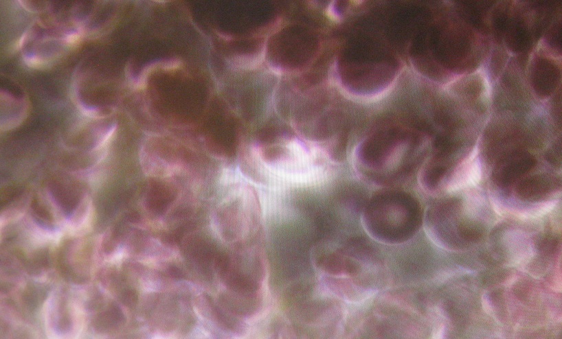 Blut gestapelt 1200fach vergrössert Blut gestapelt 1200fach vergrössert