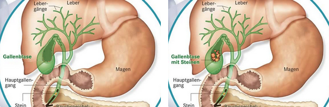 Leber, Galle und Gallenblase, Schema