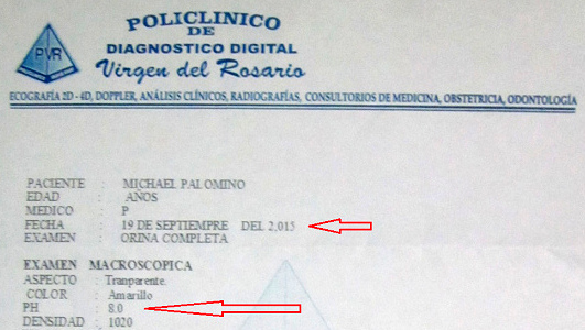 Laborbericht mit einem pH-Wert 8 im
                            Urin vom 19. September 2015