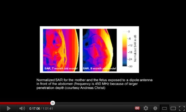 Ein
                  Handy an einem Bauch einer schwangeren Frau verstrahlt
                  den F�tus
