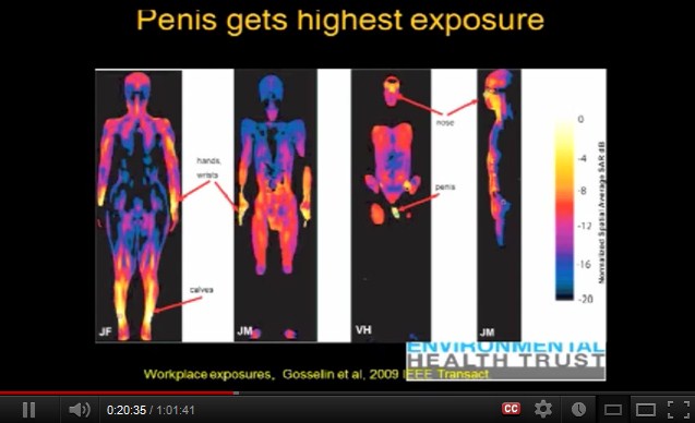 Am
                  meisten gef�hrdet sind die Gelenke, die Nase und die
                  m�nnlichen Geschlechtsorgane.