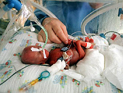 Premature birth
or even abortive birth: This play with life,
also by passive smoking... Premature birth or even
abortive birth: This play with life, also by
passive smoking...