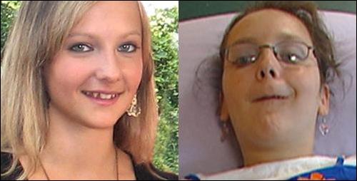 Celine vor und nach der Pille Yasmin:
                          Schwerstbehinderung durch Lungenembolie