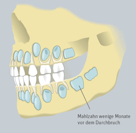 Über den Milchzähnen warten die
Erwachsenenzähne, bzw. die
Erwachsenenzähne vertreiben in der
Kindheit und Jugend die Milchzähne. Über den Milchzähnen warten die
Erwachsenenzähne, bzw. die
Erwachsenenzähne vertreiben in der
Kindheit und Jugend die Milchzähne.