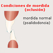Mordida normal (psalidodoncia),
                esquema
