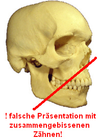 Auch das Schdelmodell des
                              anatomischen Museums Basel ist mit
                              zusammengepressten Zhnen dargestellt,
                              anatomisch vllig falsch und absolut
                              schdlich fr die Zhne