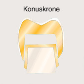 Krone: die Konuskrone f�r den Backenzahn
                        oder Mahlzahn