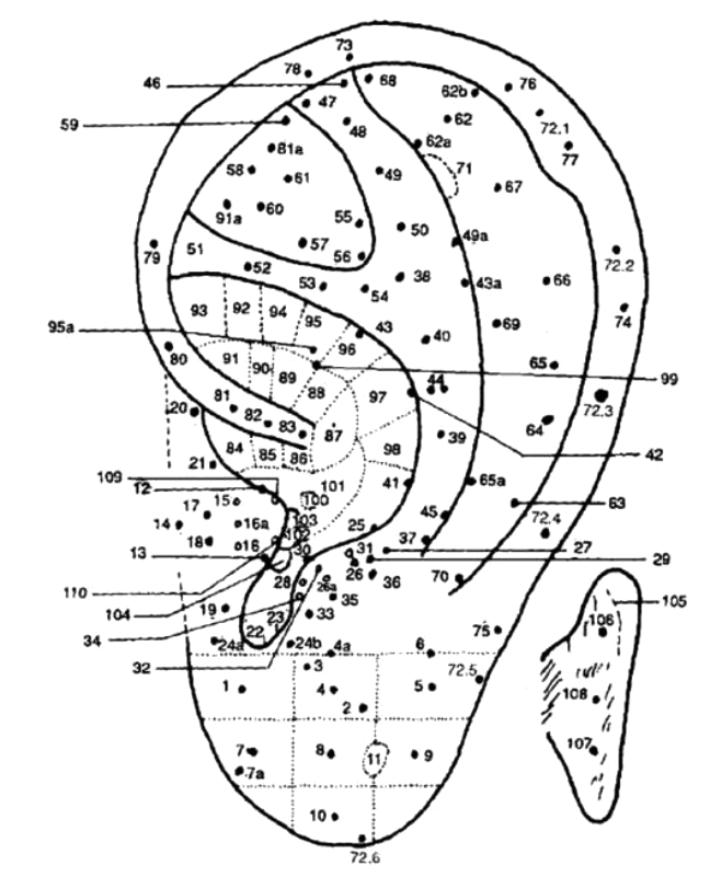 Cartograma auricular