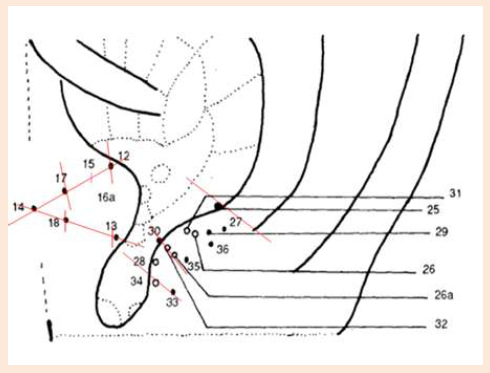 Cartograma auricular, el centro Cartograma auricular, el centro