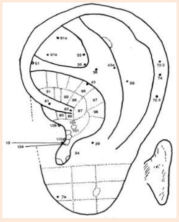 Cartograma auricular, enfasis en el
                          centro