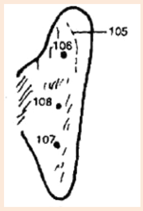 Cartograma auricular, zoom Cartograma auricular,
zoom