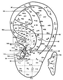 Acupuntura en la oreja, los puntos