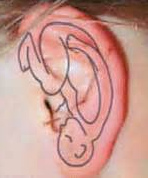 Ohrakupressur: Das Baby im Ohr