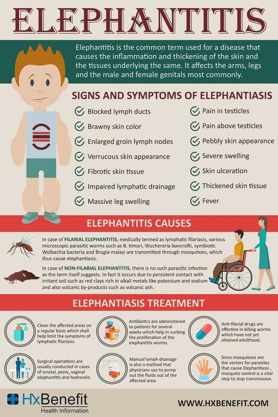 Elephantiasis, Liste der Ursachen und Symptome
(englisch) Elephantiasis, Liste der Ursachen und
Symptome (englisch)