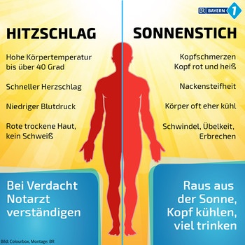 Sonnenstich Symptome, Liste: Kopfschmerzen,
roter+heisser Kopf, steifer Nacken, Körper oft eher
kühl, Schwindel, Übelkeit, Erbrechen Sonnenstich
Symptome, Liste: Kopfschmerzen, roter+heisser Kopf,
steifer Nacken, Körper oft eher kühl, Schwindel,
Übelkeit, Erbrechen
