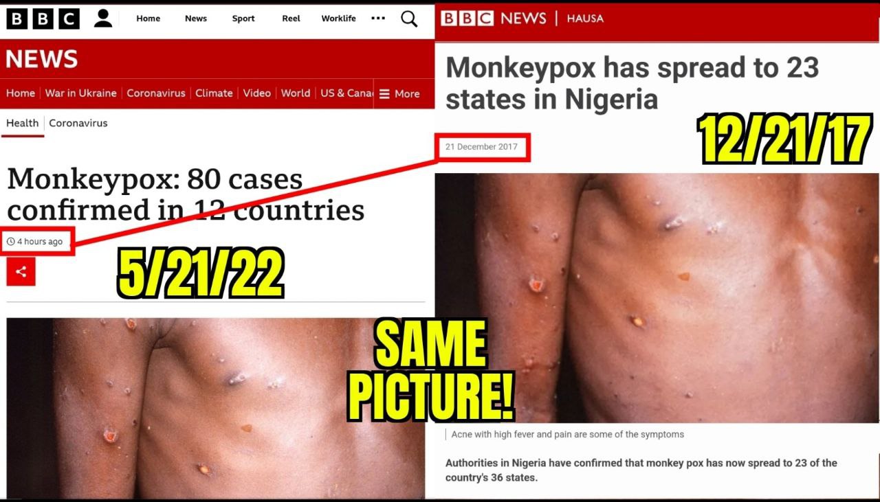 Kriminelle Rothschild-Medien 22.5.2022:
präsentieren alte Fotos von Affenpocken als
Affenpocken von 2022 01 Kriminelle
Rothschild-Medien 22.5.2022: präsentieren alte Fotos
von Affenpocken als Affenpocken von 2022 01