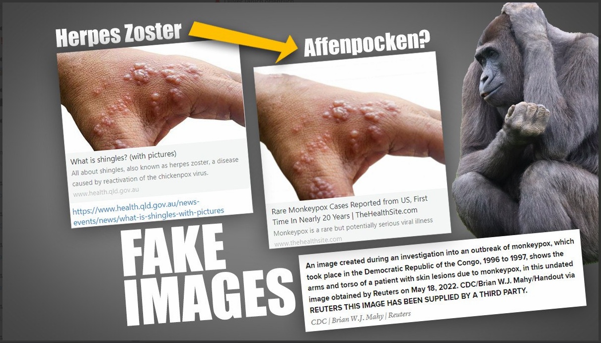 Kriminelles Rothschild-Arschloch 22.5.2022:
Medien von Rothschild fälschen auch Affenpocken:
Medienkrieg der Bilder: Wie Panik vor Affenpocken
mit Fake-Bildern geschürt wird Kriminelles
Rothschild-Arschloch 22.5.2022: Medien von
Rothschild fälschen auch Affenpocken: Medienkrieg
der Bilder: Wie Panik vor Affenpocken mit
Fake-Bildern geschürt wird