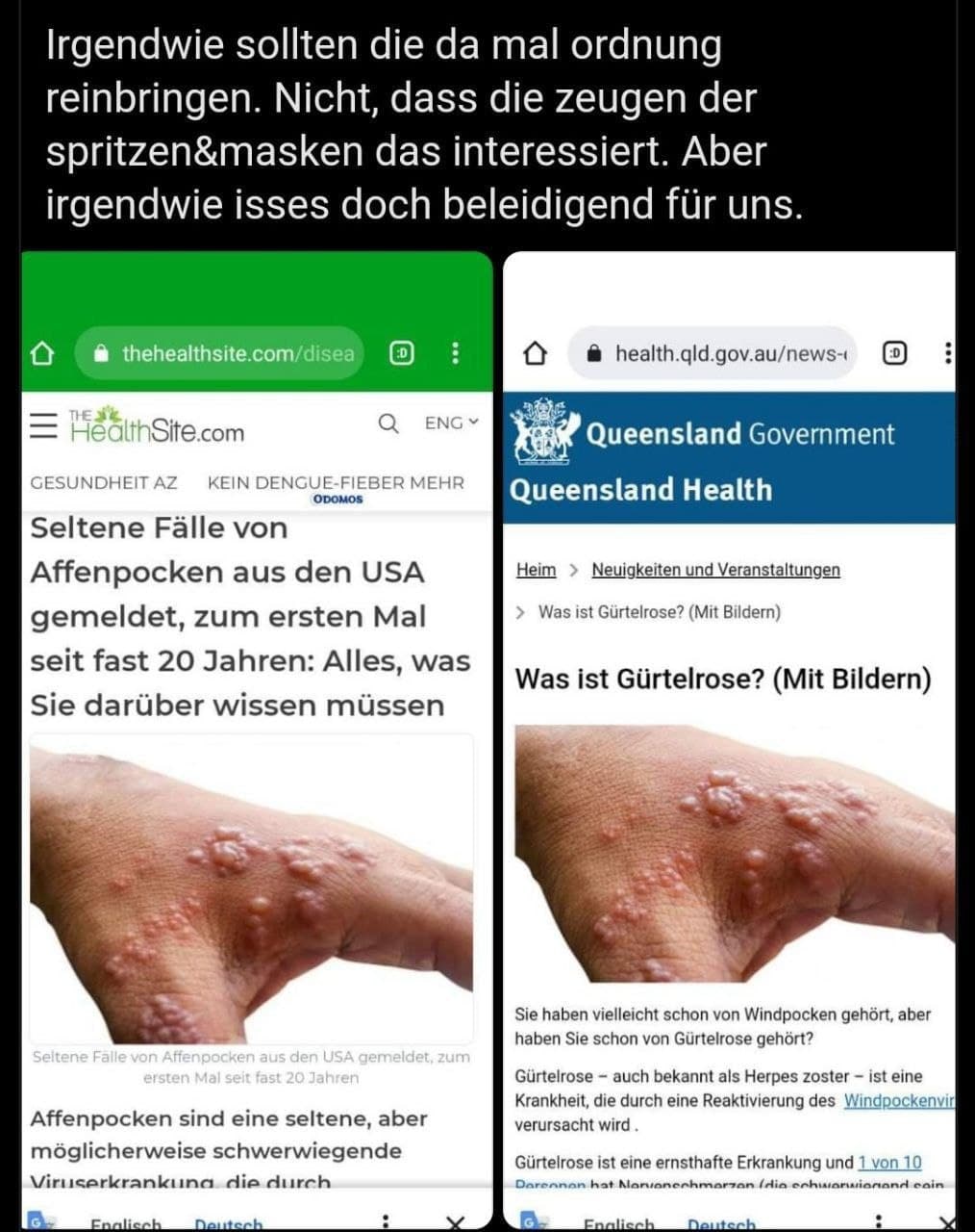 Rothschild-Verbrechen in den
Rothschild-Medien 22.5.2022: Gürtelrose als
Affenpocken dargestellt Nein, keine Affenpocken!
Gürtelrose, eine Nebenwirkung der Corona-Impfung! Rothschild-Verbrechen in den Rothschild-Medien
22.5.2022: Gürtelrose als Affenpocken dargestellt
Nein, keine Affenpocken! Gürtelrose, eine
Nebenwirkung der Corona-Impfung!