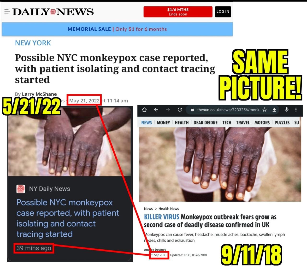 Kriminelle Rothschild-Medien 22.5.2022:
präsentieren alte Fotos von Affenpocken als
Affenpocken von 2022 02 Kriminelle
Rothschild-Medien 22.5.2022: präsentieren alte Fotos
von Affenpocken als Affenpocken von 2022 02