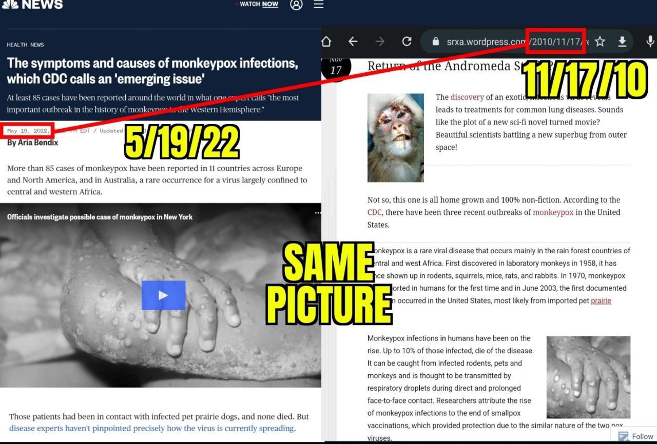 Kriminelle Rothschild-Medien 22.5.2022:
präsentieren alte Fotos von Affenpocken als
Affenpocken von 2022 03 Kriminelle
Rothschild-Medien 22.5.2022: präsentieren alte Fotos
von Affenpocken als Affenpocken von 2022 03