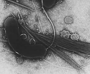 Cholera-Erreger "Vibrio
                        cholerae", volkstmlich als
                        "Kommabazillus" bezeichnet