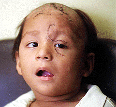 Heridas grandes en la cara por
                                    el perro de casa [23]