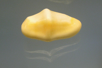 Cyphoma gibbosum, primer plano