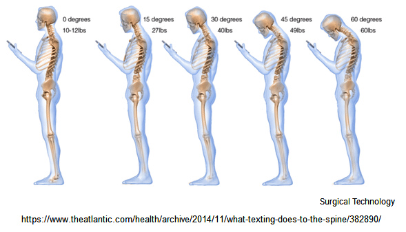 Der Handy-Buckel:
Handysucht und iPhone-Sucht provoziert einen Buckel Der Handy-Buckel: Handysucht und iPhone-Sucht
provoziert einen Buckel