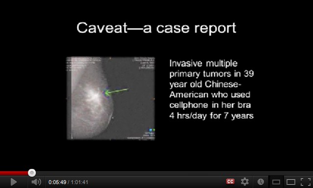 Krebs durch
              Handy an der Brust