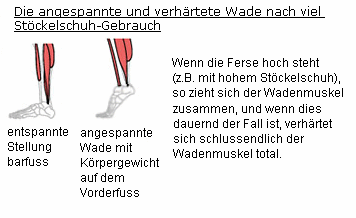 Der
                          angespannte Wadenmuskel verh�rtet total, wenn
                          die dummen Frauen viel mit hohen
                          St�ckelschuhen (High-Heels) herumlaufen