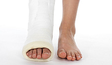 Der Gips
                  nach einem Kn�chelbruch