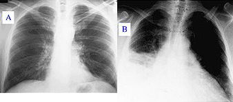...
hasta el niño negro recibió una pulmonía fuerte. ... hasta el niño
negro recibió una pulmonía fuerte.